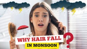 Hair Fall in Monsoon